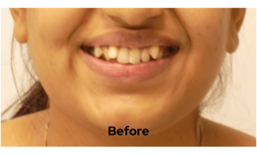 Before treatment
