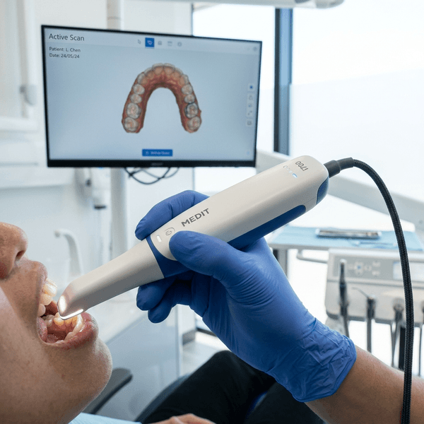 Digital Oral Scanner
