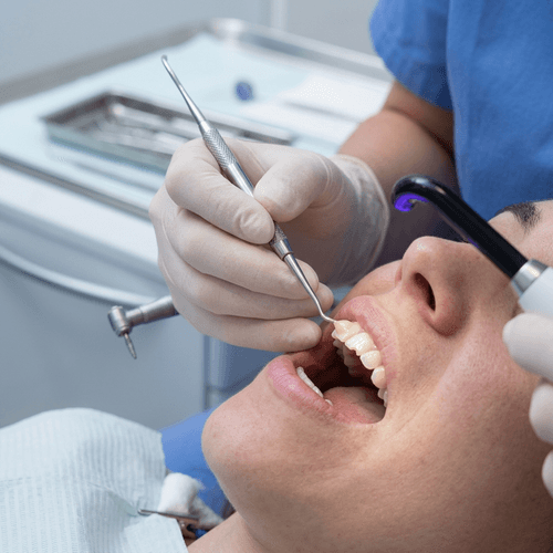Tooth Bonding Treatment Treatment in Indore - Bhardwaj Dental Clinic